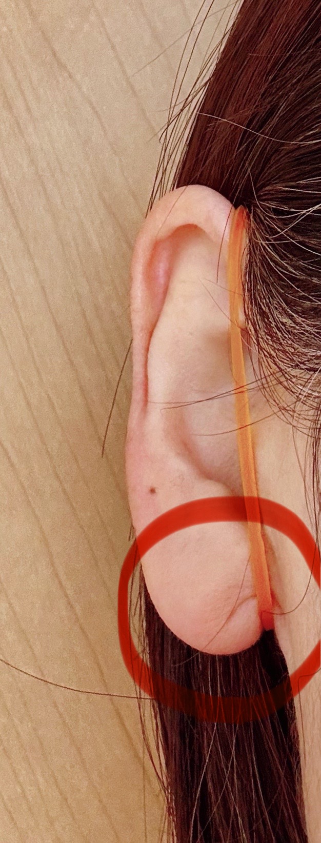 耳に輪ゴムをかけてリフトアップ