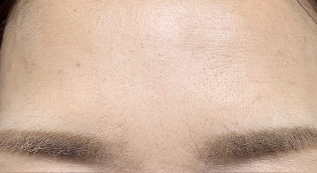 頭皮マッサージを続けた結果 3年後